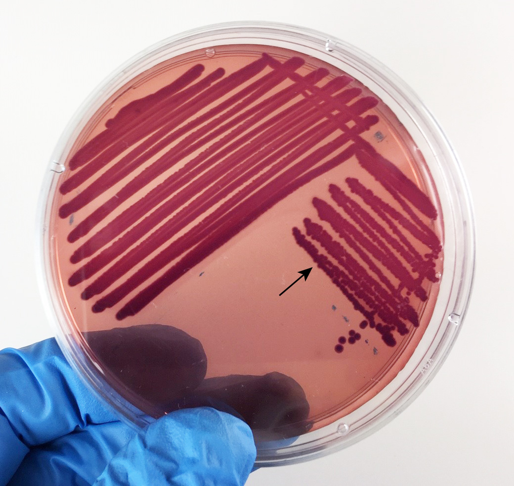 Photograph of <EM>Klebsiella (Enterobacter) aerogenes </EM> 
    growing on MacConkey agar showing weak fermentation of lactose.